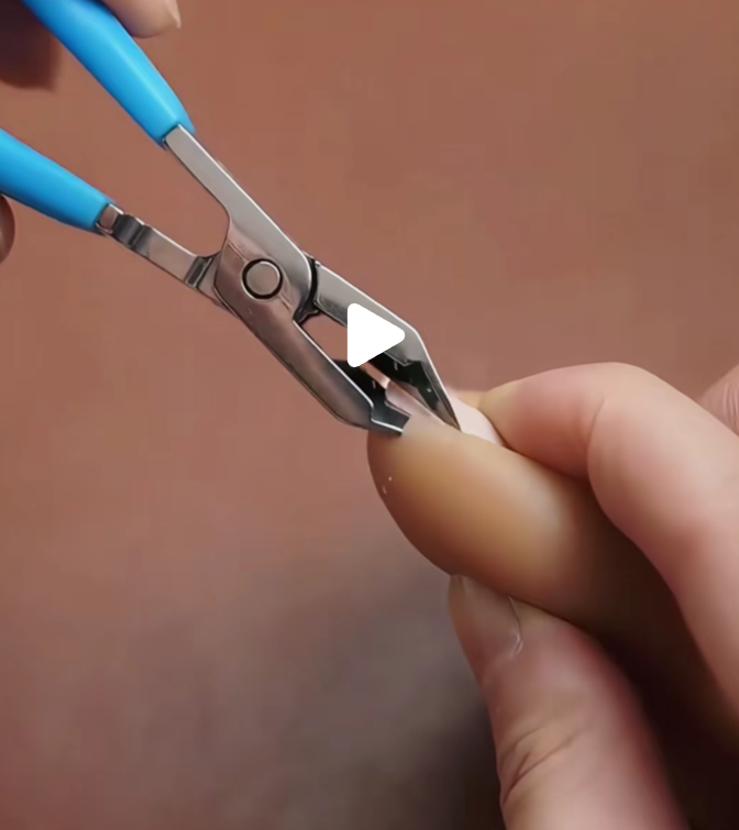Adiós a las Uñas Encarnadas. ¡Corte Preciso y Seguro!